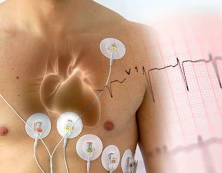 Έλεγχος και ρύθμιση ΑΠ, τοποθέτηση Holter πιέσεως