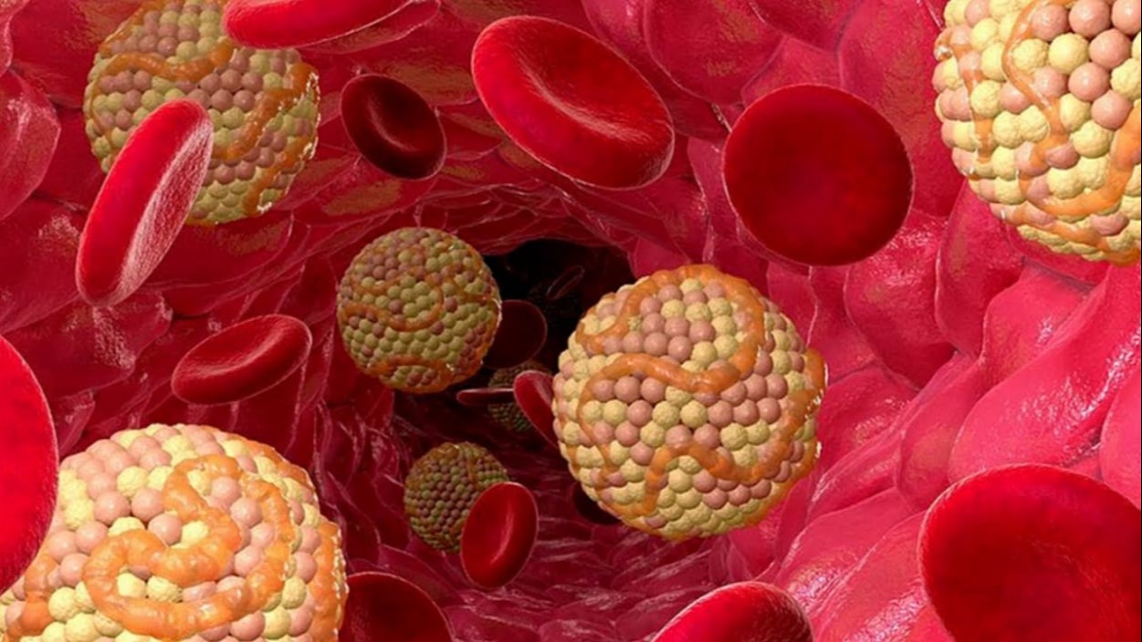 Δυσλιπιδαιμία / Υπερλιπιδαιμία