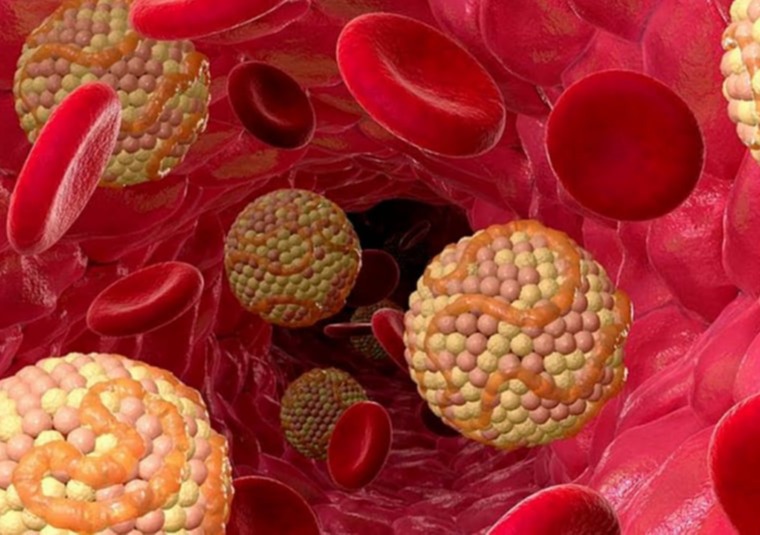 Έλεγχος και ρύθμιση υπερλιπιδαιμίας