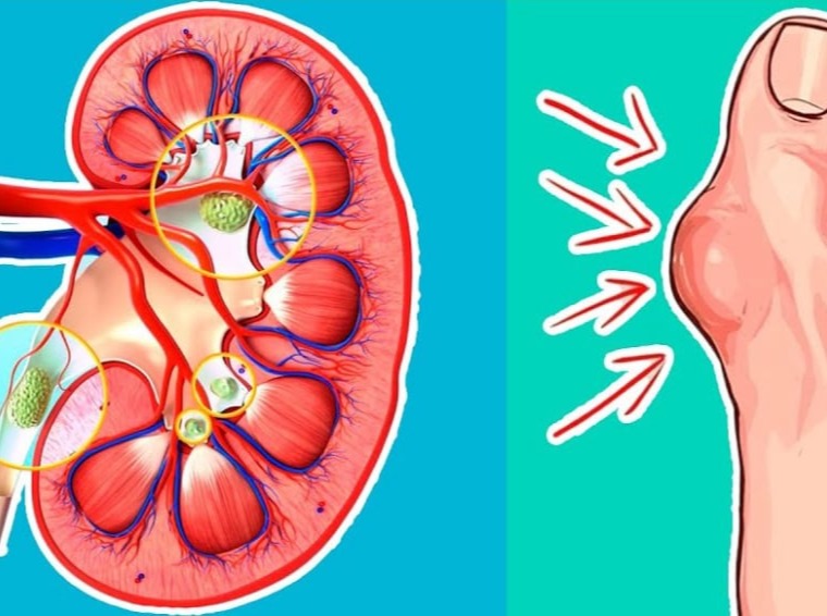 Ρύθμιση ουρικού οξέος